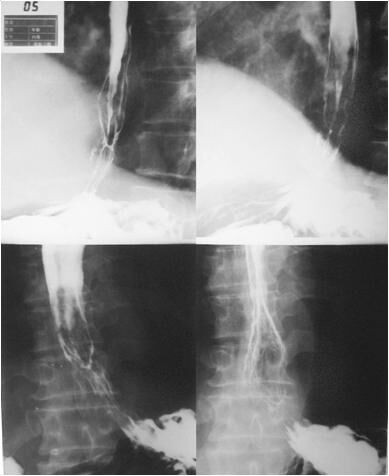 ��̬DR������������������������е�����