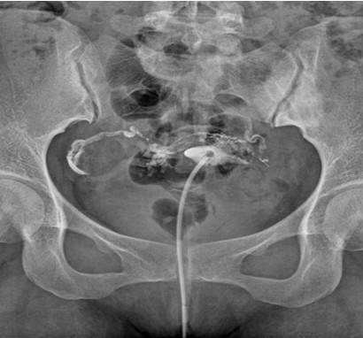 ��̬DR�ڸ��Ƽ���е��ٴ�Ӧ��
