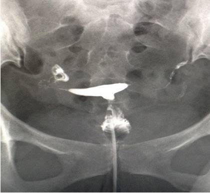 ��̬DR�ڸ��Ƽ���е��ٴ�Ӧ��