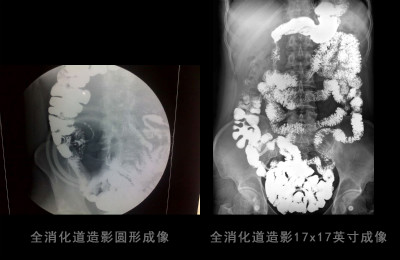 DR的可视化造影功能,不容小觑