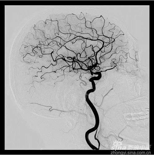 ͬ�ó��ҽԺ�ɹ���չ�Բ�������Ӱ��