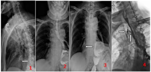 ��̬DR��ʳ������������е�Ӧ��