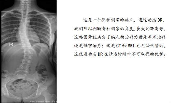 动态DR精准诊断的优势