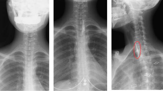 动态DR精准诊断的优势