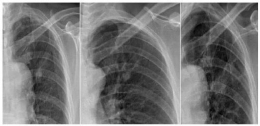 DR�۲죺û�п��ӻ���Ƭ���ΰ���ɸ�����˿���
