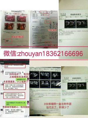 DŮ�ɺͰ�Ů���ĸ�Ч�����ã���ѡDŮ�ɶ��·���