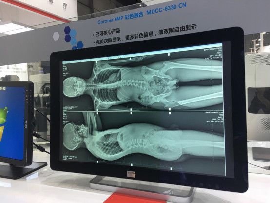 巴可亮相放射学学术大会 优质稳定守护医者仁心