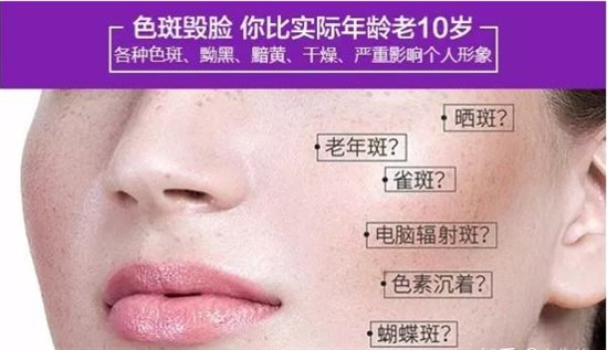 五洲整形医院:脸上长斑了怎么办?品质医美来帮你