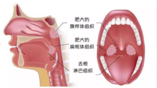 涿州儿童医院——涿州长和儿童医院携手北京儿童医院