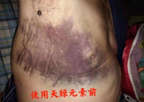 【真相】4000元一瓶的“神仙水”,心梗脑溢血都能治?